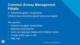 Common Airway Management
Pitfalls
4. Suboptimal glottis visualization
Children have anteriorly placed larynx and angled
The solution:
• External laryngeal manipulation
• Optimize head position
• Insert laryngoscope deeply and withdraw slowly
• Change blade type or size
• High reps
Burns BJ. Ann Emerg Med 2017
 