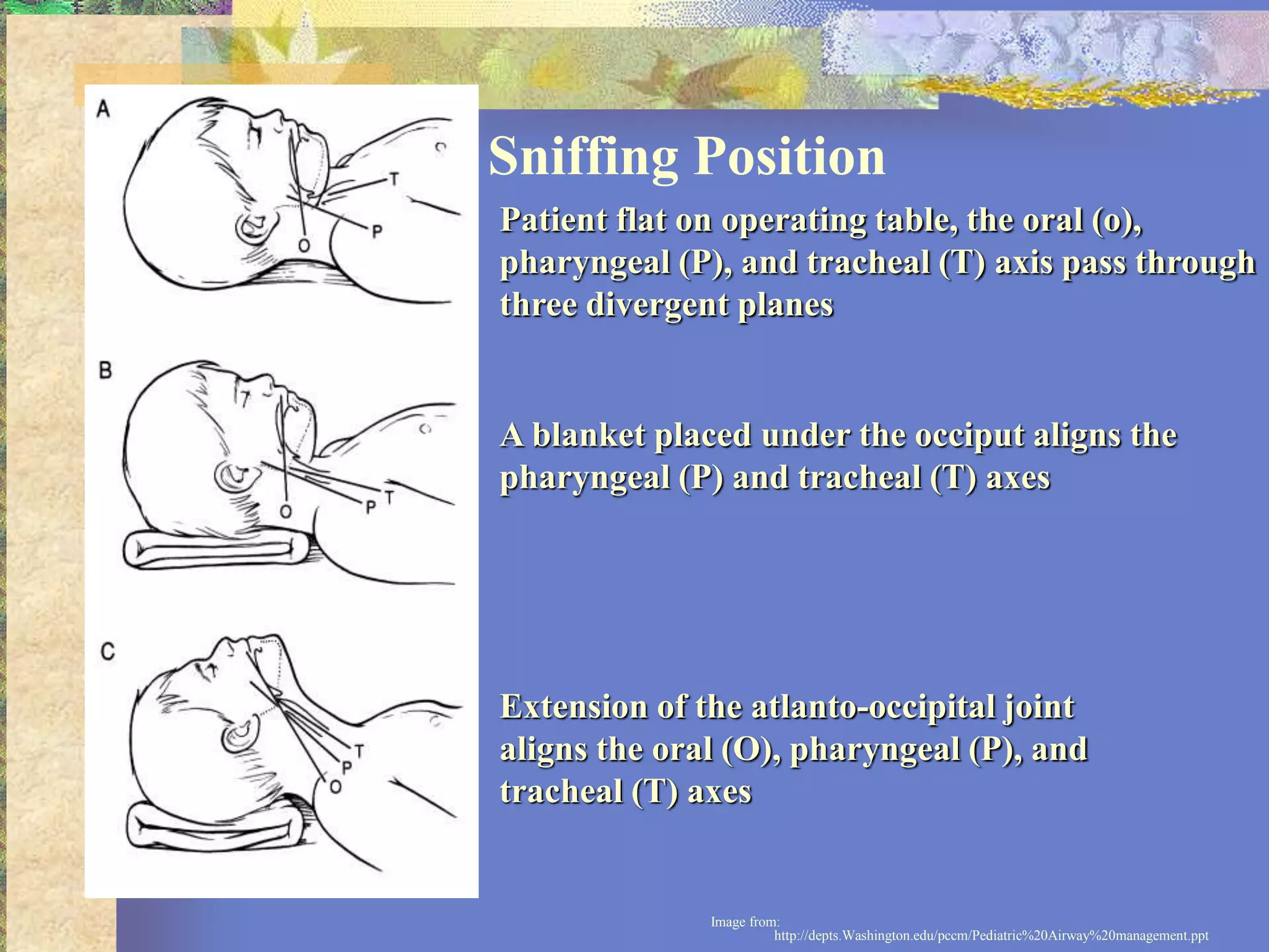 Pediatric Airway Anatomy Physiology and Management.ppt