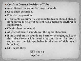 Pediatric airway management | PPTX