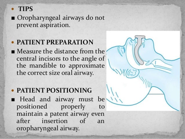 Pediatric airway management