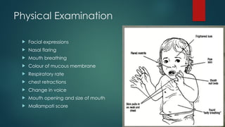 Physical Examination
 Facial expressions
 Nasal flaring
 Mouth breathing
 Colour of mucous membrane
 Respiratory rate
 chest retractions
 Change in voice
 Mouth opening and size of mouth
 Mallampati score
 