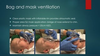 Bag and mask ventilation
 Clear plastic mask with inflatable rim provides atraumatic seal.
 Proper area for mask application- bridge of nose extend to chin.
 Maintain airway pressure < 20cm H2O.
 