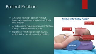 Patient Position
 A neutral “sniffing” position without
hyperextension is appropriate for infants
and toddlers.
 Avoid extreme hyperextension in infants as
it may cause airway obstruction
 In patients with head or neck injuries,
maintain the neck in a neutral position.
 