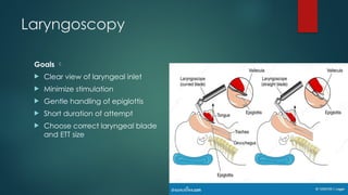 Laryngoscopy
Goals 
 Clear view of laryngeal inlet
 Minimize stimulation
 Gentle handling of epiglottis
 Short duration of attempt
 Choose correct laryngeal blade
and ETT size
 