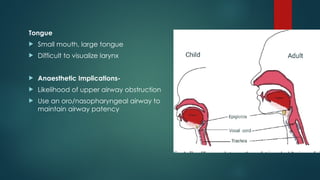 Tongue
 Small mouth, large tongue
 Difficult to visualize larynx
 Anaesthetic Implications-
 Likelihood of upper airway obstruction
 Use an oro/nasopharyngeal airway to
maintain airway patency
 