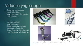Video laryngoscope
 The most commonly
available video
laryngoscopes for use in
children are:
 Airtraq optical
laryngoscope,
Glidescope (Verathan
Medical), CMac (Karl
Storz), Truview (Truphatek)
and Pentax AWS (Pentax).
 