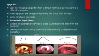 Epiglottis
 Leaf like, hanging epiglottis which is difficult to lift and glottic opening is
difficult to visualize
 Infant epiglottis are omega shaped and axis away from trachea
 Large tonsil and adenoids
 Anaesthetic Implications-
 Choose an appropriate laryngeal blade (Miller blade) to directly lift the
epiglottis
 Likelihood of upper airway obstruction and bleeding during oral/nasal
intubation
 Gentle laryngoscopy and ETT insertion
 