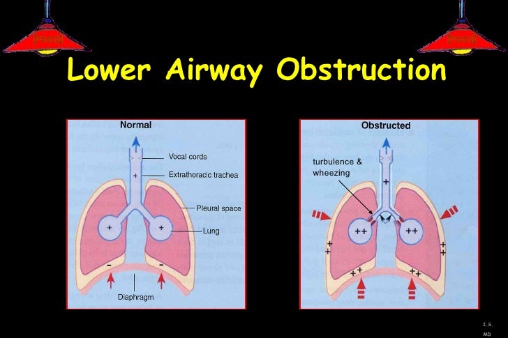Pediatric airway management shapiro