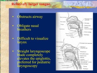 Relatively larger tongue


• Obstructs airway

• Obligate nasal
  breathers

• Difficult to visualize
  larynx

• Straight laryngoscope
  blade completely
  elevates the epiglottis,
  preferred for pediatric
  laryngoscopy
 