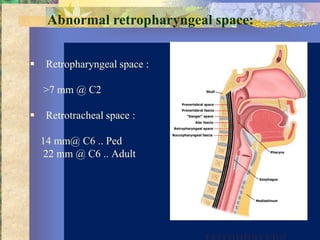Abnormal retropharyngeal space:


    Retropharyngeal space :

    >7 mm @ C2

    Retrotracheal space :

    14 mm@ C6 .. Ped
    22 mm @ C6 .. Adult
 