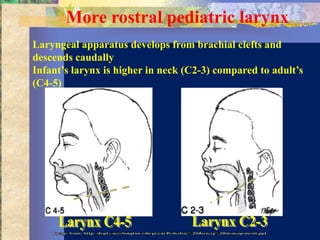 More rostral pediatric larynx
Laryngeal apparatus develops from brachial clefts and
descends caudally
Infant’s larynx is higher in neck (C2-3) compared to adult’s
(C4-5)
 