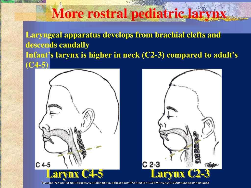 Pediatric airway obstruction