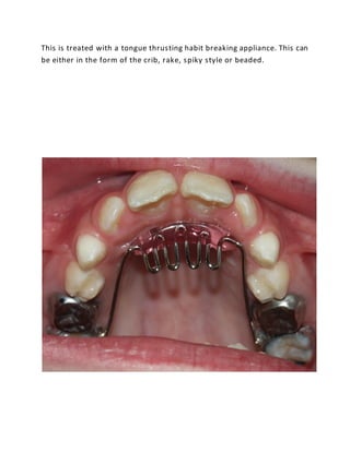 Crib Or Rake Pediatric and a periodontal dental treatment - deccan multispeciality | PDF