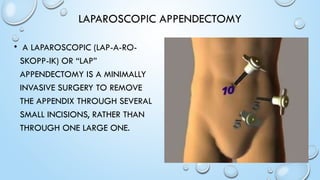 discussion on Pediatric Appendicitis case.pptx