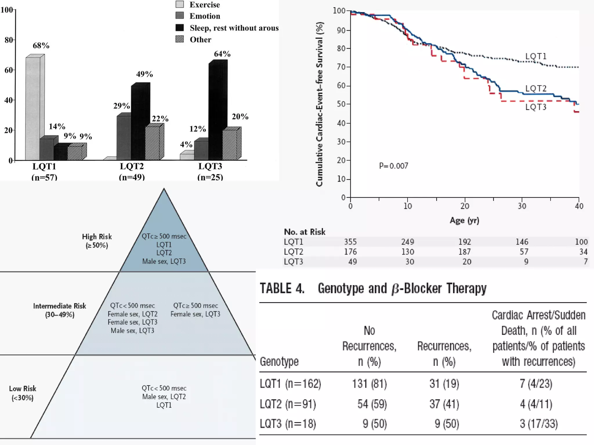 ß-blocker therapy Left cardiac sympathetic denervation ICD implantation 