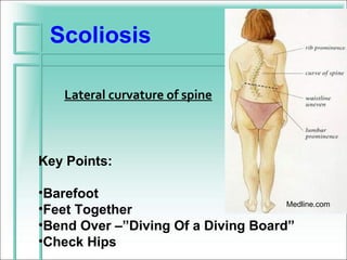 Scoliosis

    Lateral curvature of spine



Key Points:

•Barefoot
                                     Medline.com
•Feet Together
•Bend Over –”Diving Of a Diving Board”
•Check Hips
 