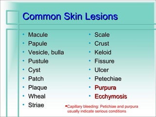 Common Skin Lesions
•   Macule                       • Scale
•   Papule                       • Crust
•   Vesicle, bulla               • Keloid
•   Pustule                      • Fissure
•   Cyst                         • Ulcer
•   Patch                        • Petechiae
•   Plaque                       • Purpura
•   Wheal                        • Ecchymosis
•   Striae         Capillary bleeding: Petichiae and purpura

                        usually indicate serious conditions
 