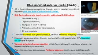 JIA-associated anterior uveitis (JIA-U): :
• JIA is the most common systemic disorder seen in paediatric uveitis clinics, affecting
between 30% and 80% of children with uveitis.
• Risk factors for ocular involvement in patients with JIA include
o Female sex, (F:M=3:2)
o Oligoarticular arthritis,
o Young age at onset of arthritis,
o Antinuclear antibody (ANA) seropositivity
o RF sero-negativity.
• Typically bilateral, non-granulomatous, and has a chronic relapsing course.
• However, a granulomatous disease, mutton-fat keratic precipitates (KPs) does not
exclude the diagnosis
• Variable anterior chamber reaction with inflammatory cells in anterior vitreous can
be seen in slit lamp examination.
• Posterior synechiae are common. Posterior segment involvement in JIA is usually
rare. Clarke et al. Pediatric Rheumatology (2016) 14:27 DOI 10.1186/s12969-016-0088-2
 