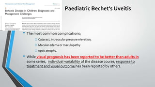 Paediatric Bechet's Uveitis
• The most common complications;
o Cataract, intraocular pressure elevation,
o Macular edema or maculopathy
o optic atrophy.
• While visual prognosis has been reported to be better than adults in
some series, individual variability of the disease course, response to
treatment and visual outcome has been reported by others.
 