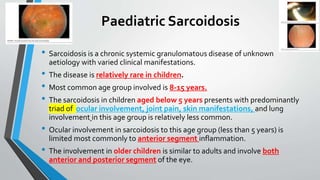 Paediatric Sarcoidosis
• Sarcoidosis is a chronic systemic granulomatous disease of unknown
aetiology with varied clinical manifestations.
• The disease is relatively rare in children.
• Most common age group involved is 8-15 years.
• The sarcoidosis in children aged below 5 years presents with predominantly
triad of ocular involvement, joint pain, skin manifestations, and lung
involvement in this age group is relatively less common.
• Ocular involvement in sarcoidosis to this age group (less than 5 years) is
limited most commonly to anterior segment inflammation.
• The involvement in older children is similar to adults and involve both
anterior and posterior segment of the eye.
 