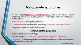 Masquerade syndromes
• Common signs of posterior segment involvement in leukaemia include vascular
sheathing, perivascular exudates, retinal haemorrhages, cotton-wool spots, and
hard exudates.
• Retinal infarction, though rare, can occur.
• Anterior chamber inflammation is relatively uncommon and rarely children.
• Slit lamp examination help in examination.
Juvenile xanthogranuloma
• Is a disorder of unknown etiology,
• Characterized by abnormal proliferation of non-langerhans histiocytes.
• Very rarely, juvenile xanthogranuloma can masquerade as uveitis in childhood in
the absence of skin lesions.
Zamir E,etal 2001
 