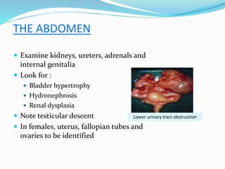 THE ABDOMEN
 Examine kidneys, ureters, adrenals and
internal genitalia
 Look for :
 Bladder hypertrophy
 Hydronephrosis
 Renal dysplasia
 Note testicular descent
 In females, uterus, fallopian tubes and
ovaries to be identified
Lower urinary tract obstruction
 