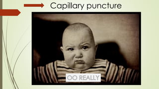 Capillary puncture
 