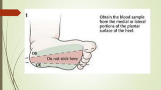 Pediatric blood sampling technique