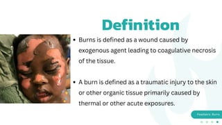 Comprehensive Guide to Pediatric Burns: Causes, Classification, and ...