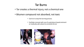 Tar Injury Pediatric burns seminar | PPTX