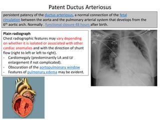 Pediatric Cardiology (1).pptx