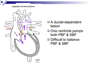  A ductal-dependent
  lesion
 One ventricle pumps
  both PBF & SBF
 Difficult to balance
  PBF & SBF
 