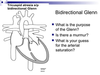 Bidirectional Glenn

   What is the purpose
    of the Glenn?
   Is there a murmur?
   What is your guess
    for the arterial
    saturation?
 