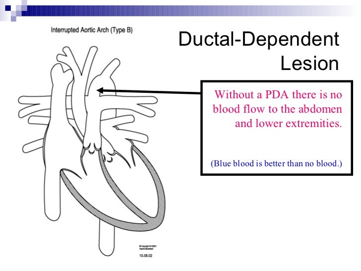 PediatricCardiology101.ppt