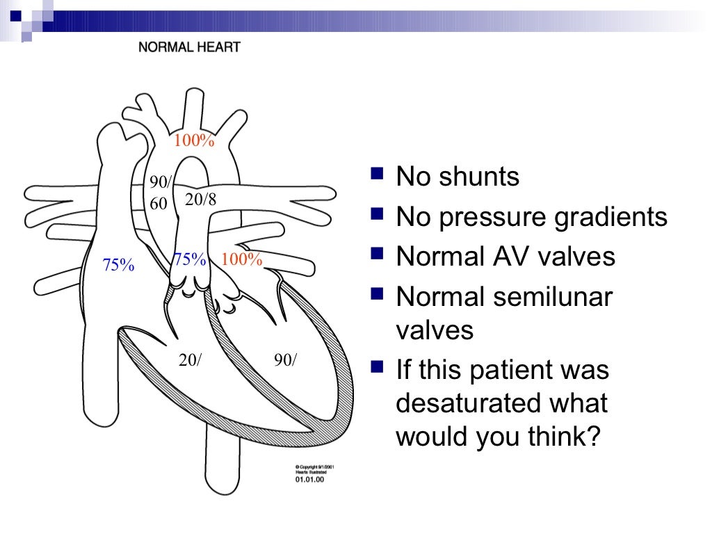 PediatricCardiology101.ppt