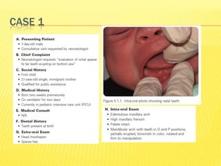 Pediatric case studies | PPTX