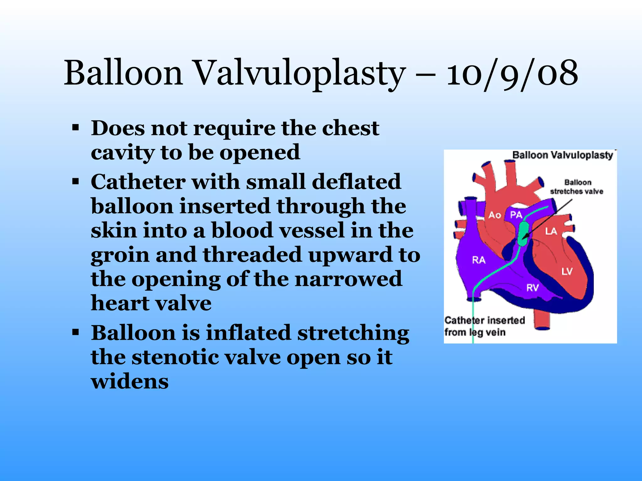 Balloon Valvuloplasty – 10/9/08 Does not require the chest cavity to be opened Catheter with small deflated balloon inserted through the skin into a blood vessel in the groin and threaded upward to the opening of the narrowed heart valve Balloon is inflated stretching the stenotic valve open so it widens 