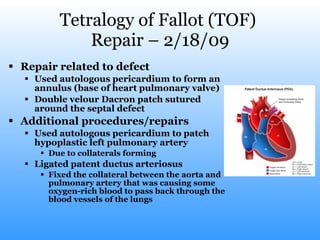 Tetralogy of Fallot (TOF)  Repair – 2/18/09 Repair related to defect Used autologous pericardium to form an annulus (base of heart pulmonary valve) Double velour Dacron patch sutured around the septal defect  Additional procedures/repairs Used autologous pericardium to patch hypoplastic left pulmonary artery Due to collaterals forming Ligated patent ductus arteriosus Fixed the collateral between the aorta and pulmonary artery that was causing some oxygen-rich blood to pass back through the blood vessels of the lungs  