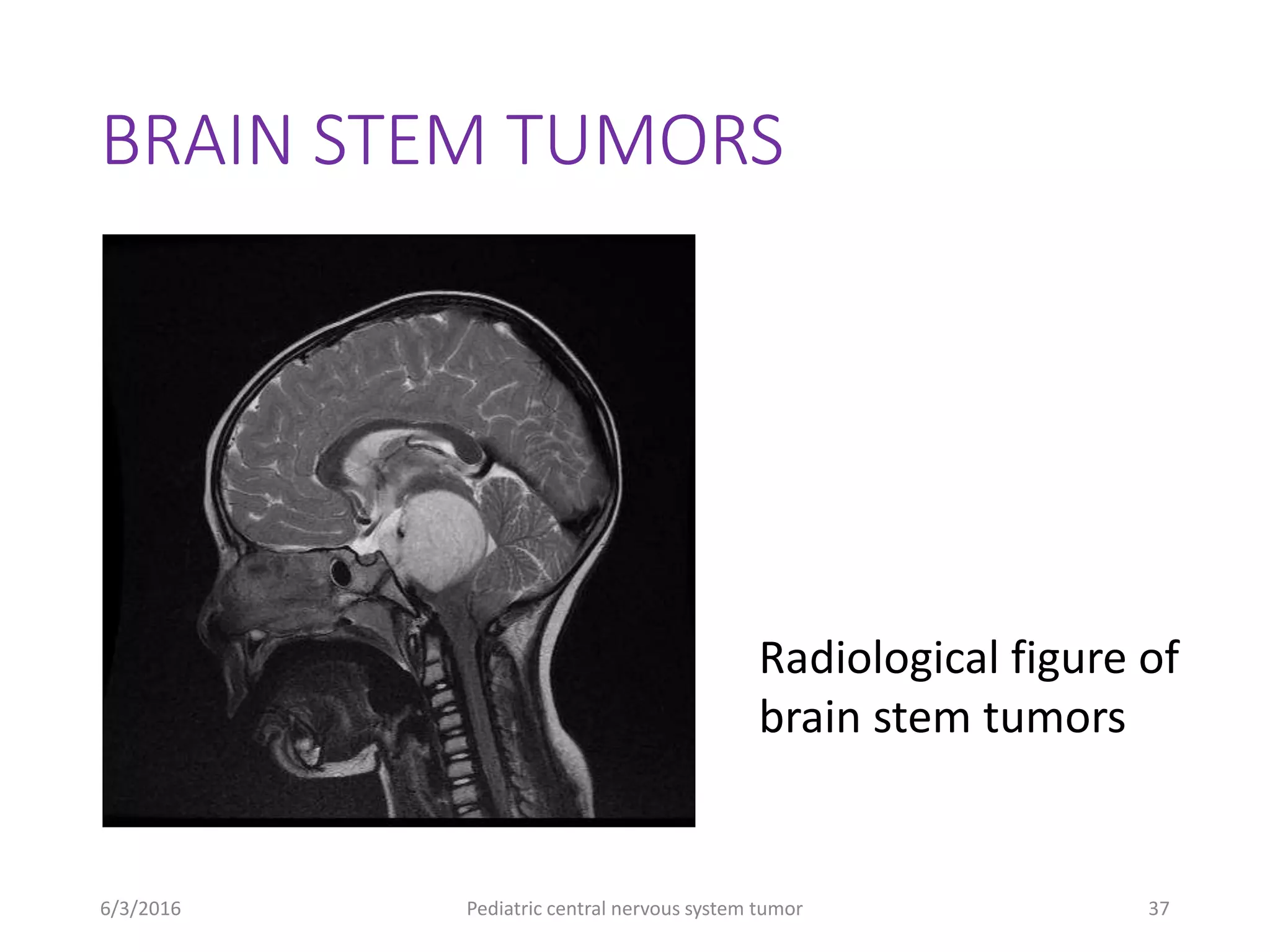 Pediatric cental nervous system tumors | PPTX