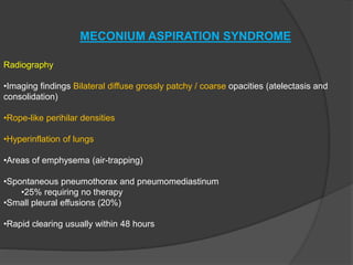 MECONIUM ASPIRATION SYNDROME
Radiography
•Imaging findings Bilateral diffuse grossly patchy / coarse opacities (atelectasis and
consolidation)
•Rope-like perihilar densities
•Hyperinflation of lungs
•Areas of emphysema (air-trapping)
•Spontaneous pneumothorax and pneumomediastinum
•25% requiring no therapy
•Small pleural effusions (20%)
•Rapid clearing usually within 48 hours
 