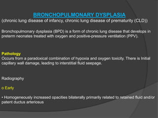 BRONCHOPULMONARY DYSPLASIA
(chronic lung disease of infancy, chronic lung disease of prematurity (CLD))
Bronchopulmonary dysplasia (BPD) is a form of chronic lung disease that develops in
preterm neonates treated with oxygen and positive-pressure ventilation (PPV).
Radiography
o Early
• Homogeneously increased opacities bilaterally primarily related to retained fluid and/or
patent ductus arteriosus
Pathology
Occurs from a paradoxical combination of hypoxia and oxygen toxicity. There is Initial
capillary wall damage, leading to interstitial fluid seepage.
 