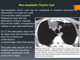 Non-neoplastic thymic cyst may be congenital or acquired secondary to
inflammation. It is seen as a well
Circumscribed antero-superior
Mediastinal mass with low
attenuation contents. Typically,
they are thin walled, homogeneous
masses of near water attenuation
On CT the attenuation value may
be higher than that of simple cysts
when the contents are
proteinaceous
or hemorrhagic rather than serous.
The cystic mass may be uni- or
multiloculated and may show
curvilinear calcification of the
cystic wall or septa .
Non-neoplastic Thymic Cyst
 