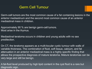 Germ Cell Tumour
Germ-cell tumors are the most common cause of a fat containing lesions in the
anterior mediastinum and the second most common cause of an anterior
mediastinal mass in children.
Approximately 90 % are benign germ-cell tumors.
Most arise in the thymus.
Mediastinal teratoma occurs in children and young adults with no sex
predilection.
On CT, the teratoma appears as a multi-locular cystic tumour with walls of
variable thickness. The combination of fluid, soft tissue, calcium, and fat
attenuation in an anterior mediastinal mass is a highly specific finding that
allows the prospective diagnosis of mature teratoma. Mature teratomas can be
very large and still be benign.
A fat-fluid level produced by high lipid content in the cyst fluid is a rare but
diagnostic sign.
 