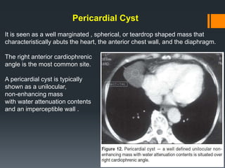 Pericardial Cyst
It is seen as a well marginated , spherical, or teardrop shaped mass that
characteristically abuts the heart, the anterior chest wall, and the diaphragm.
The right anterior cardiophrenic
angle is the most common site.
A pericardial cyst is typically
shown as a unilocular,
non-enhancing mass
with water attenuation contents
and an imperceptible wall .
 