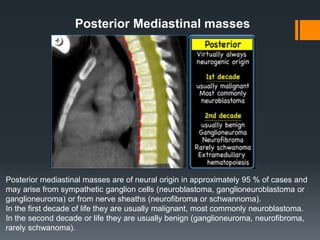 Posterior Mediastinal masses
Posterior mediastinal masses are of neural origin in approximately 95 % of cases and
may arise from sympathetic ganglion cells (neuroblastoma, ganglioneuroblastoma or
ganglioneuroma) or from nerve sheaths (neurofibroma or schwannoma).
In the first decade of life they are usually malignant, most commonly neuroblastoma.
In the second decade or life they are usually benign (ganglioneuroma, neurofibroma,
rarely schwanoma).
 
