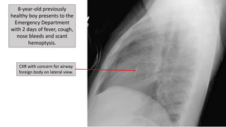 Drs. Potter and Richardson's CMC Pediatric X-Ray Mastery December Cases
