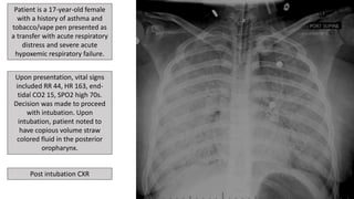 Drs. Potter and Richardson's CMC Pediatric X-Ray Mastery December Cases