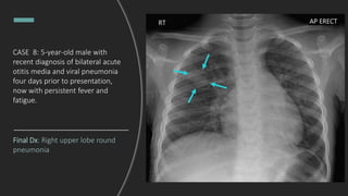Final Dx: Right upper lobe round
pneumonia
CASE 8: 5-year-old male with
recent diagnosis of bilateral acute
otitis media and viral pneumonia
four days prior to presentation,
now with persistent fever and
fatigue.
 