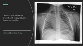 CASE 9: 3-year-old female
presents with fever, productive
cough, and vomiting.
Interpret this chest X-ray.
 