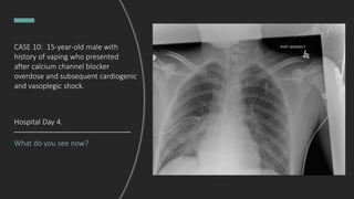 What do you see now?
Hospital Day 4.
CASE 10: 15-year-old male with
history of vaping who presented
after calcium channel blocker
overdose and subsequent cardiogenic
and vasoplegic shock.
 